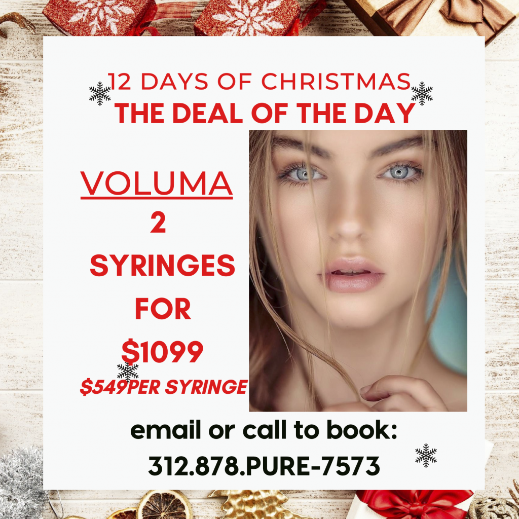 Fillers Deals in Chicago for Christmas