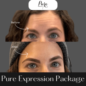 PURE Expression Package