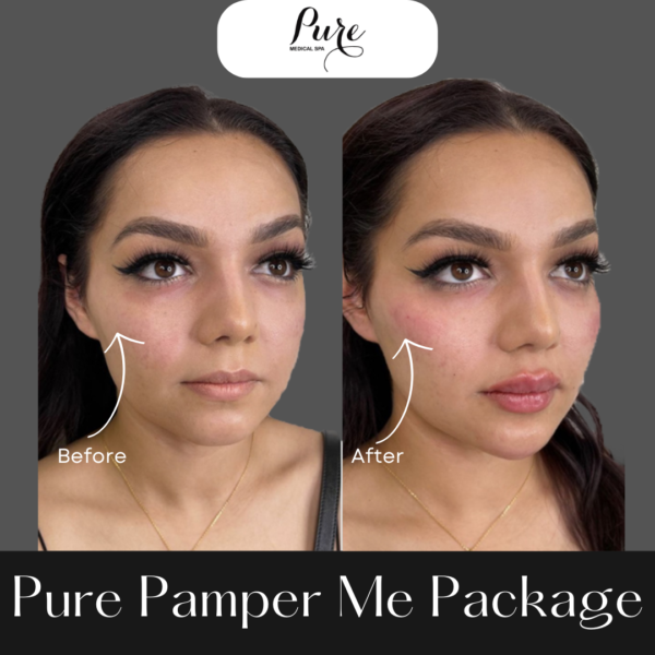Pure Pamper Me Package Pure Medical Spa