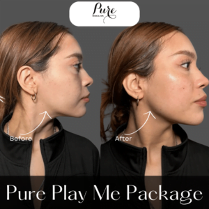 PURE Play Me Package