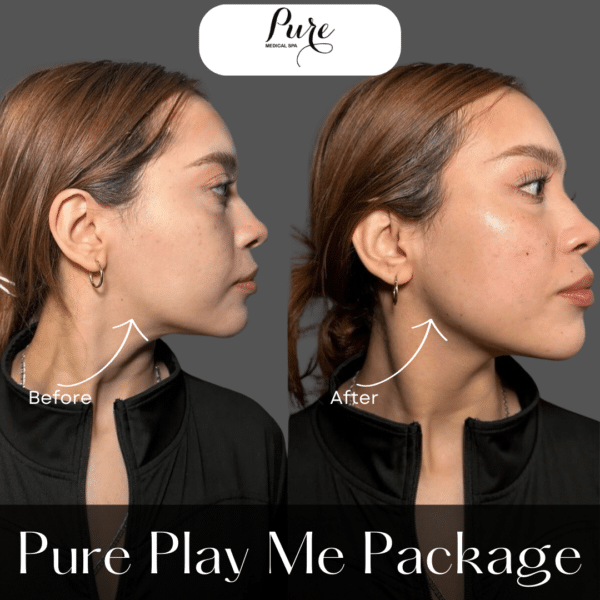 PURE Play Me Package