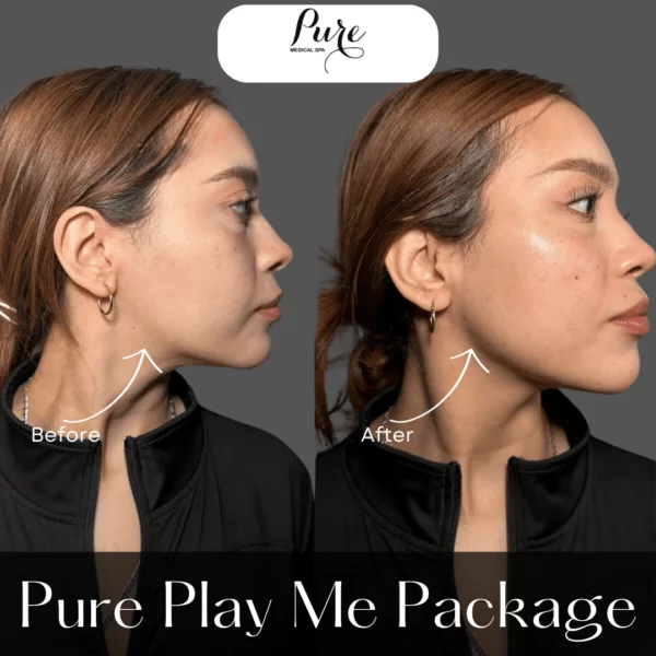 PURE Play Me Package