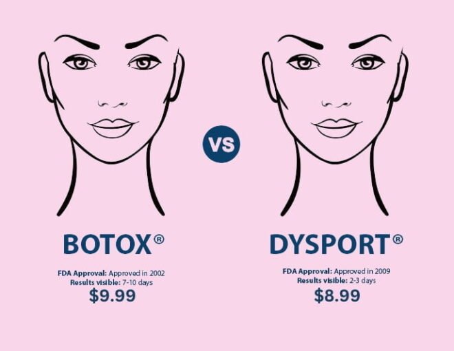 Dysport vs Botox Dysport vs Botox