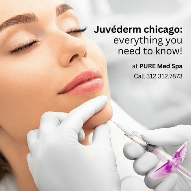 Juvéderm chicago everything you need to know!