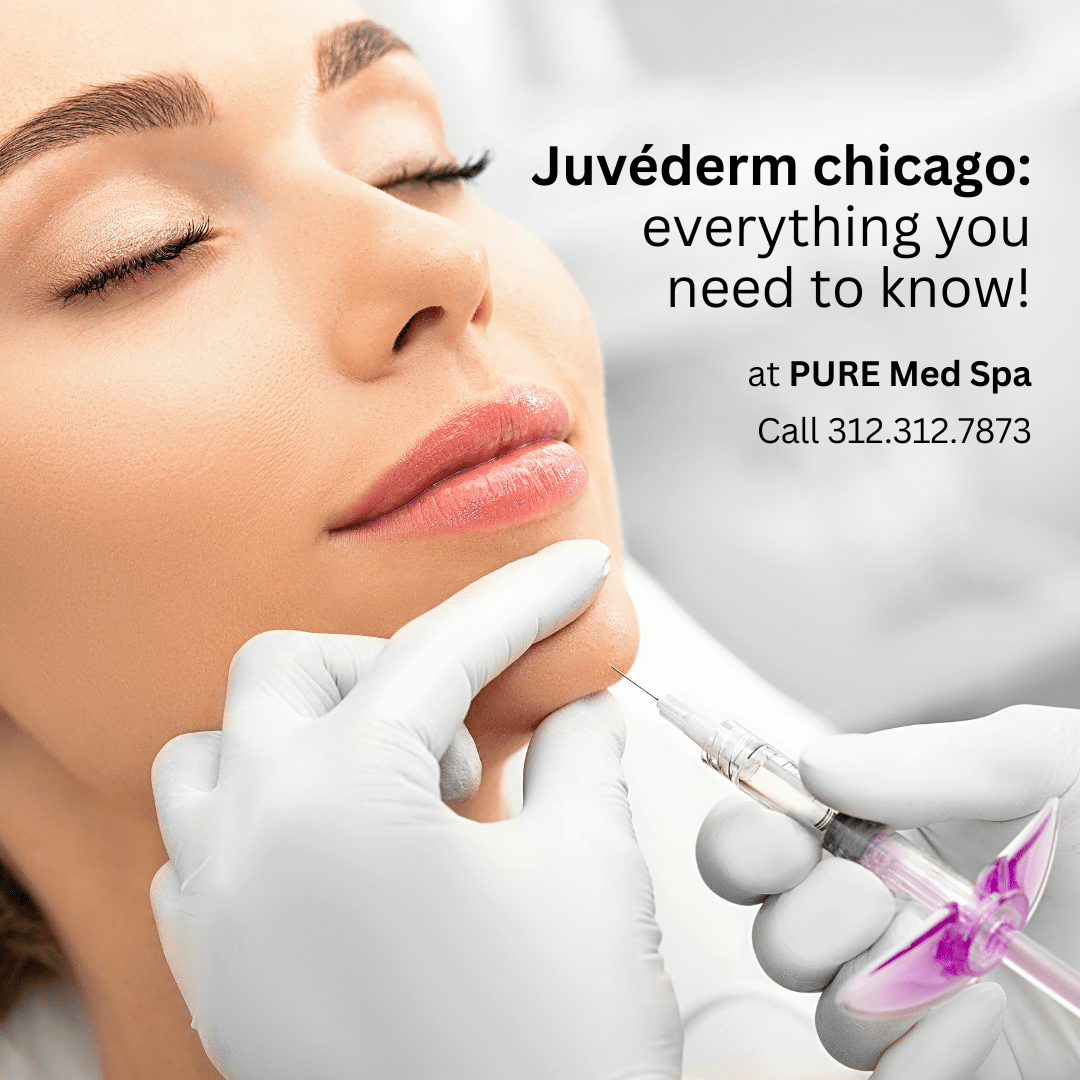 Juvéderm chicago everything you need to know Juvéderm chicago everything you need to know!