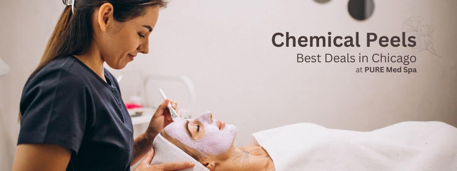 Chemical Peel Chicago Banner