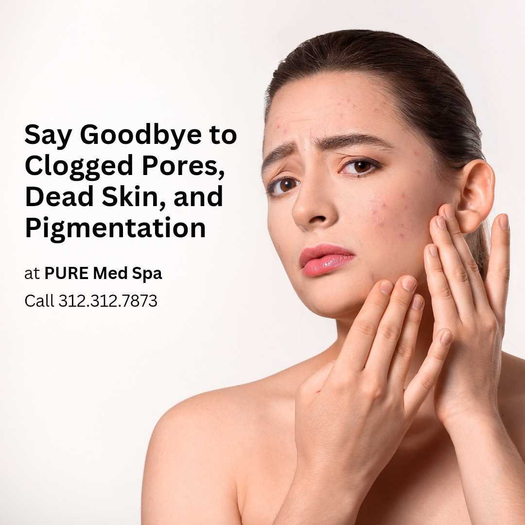 clogged-pores-dead-skin clogged-pores-dead-skin