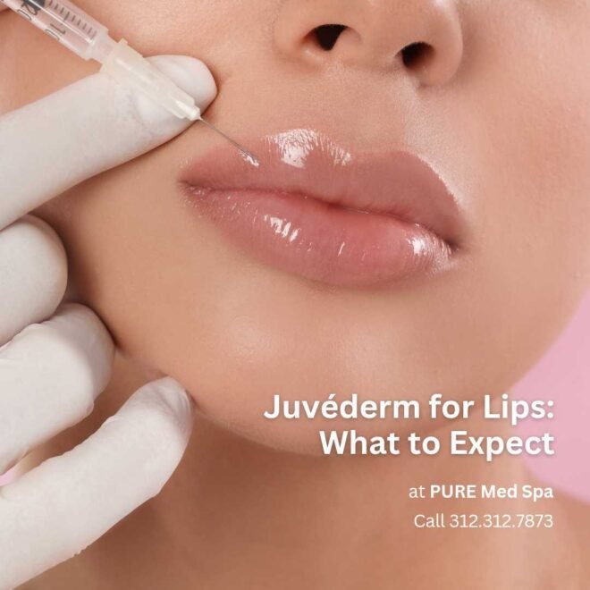 juvederm-for-lips