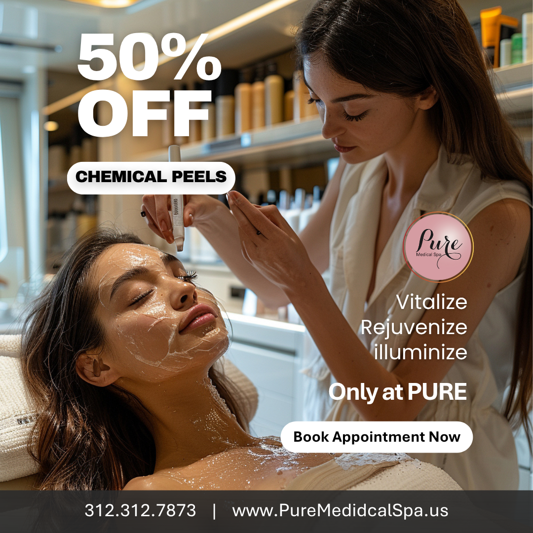 50% OFF Chemical Peels, 15 July 2025 50% OFF Chemical Peels