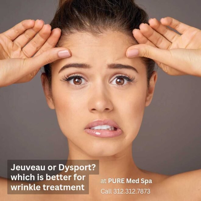 Jeuveau-or-dysport