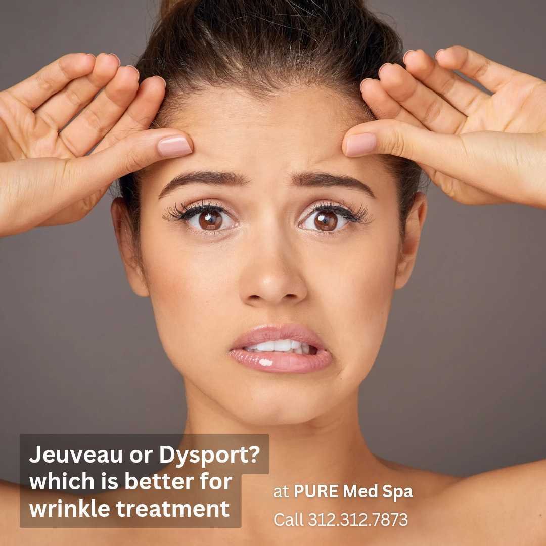 Jeuveau-or-dysport Jeuveau-or-dysport