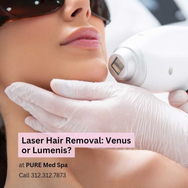 Venus or lumenis