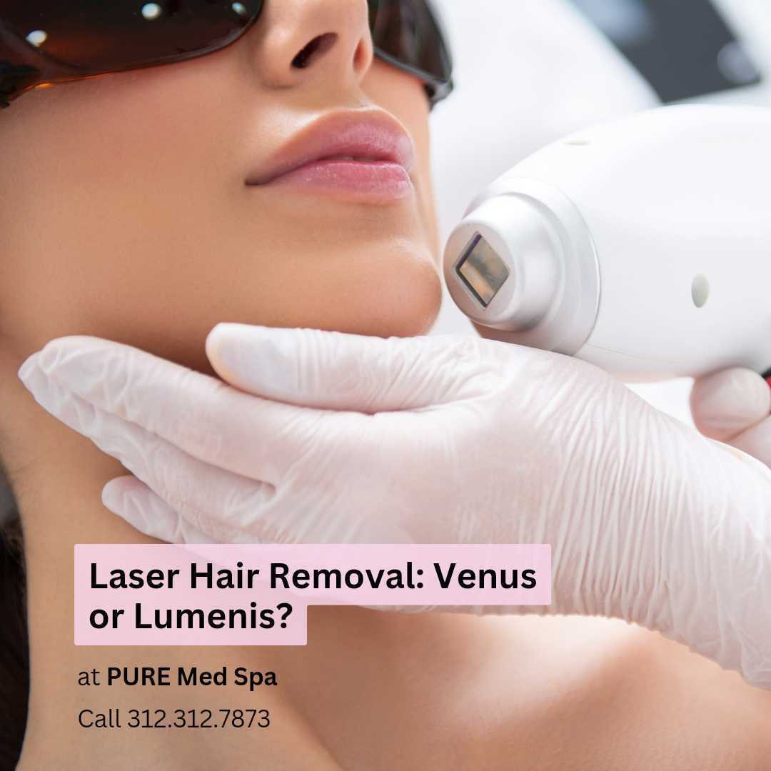 Venus or-lumenis Venus or lumenis
