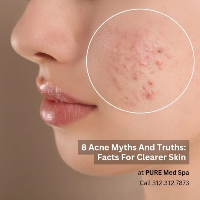 acne-myths