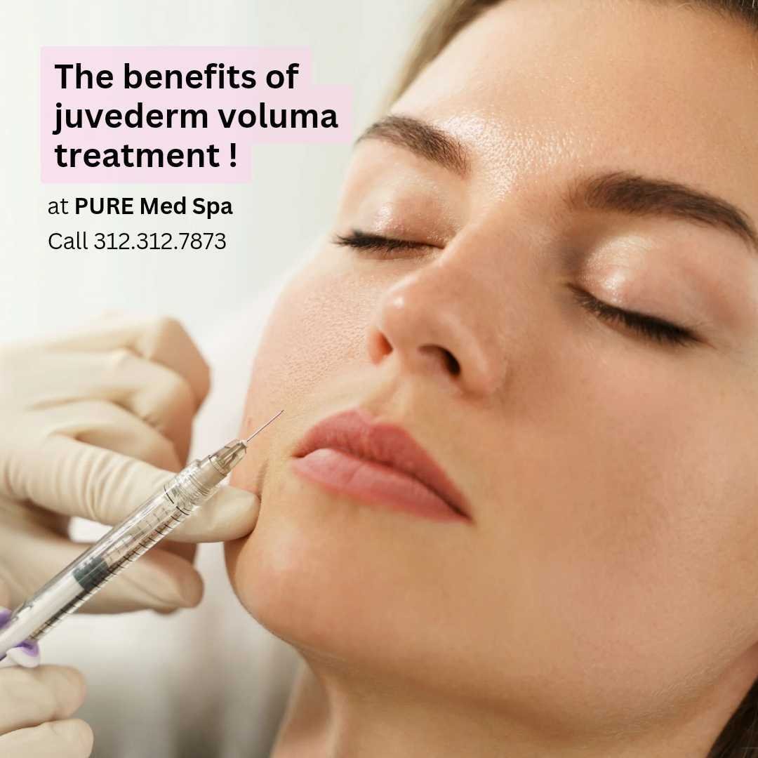 Benefits of Juvederm Voluma Treatment Benefits of Juvederm Voluma Treatment