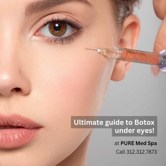 botox-under-eyes