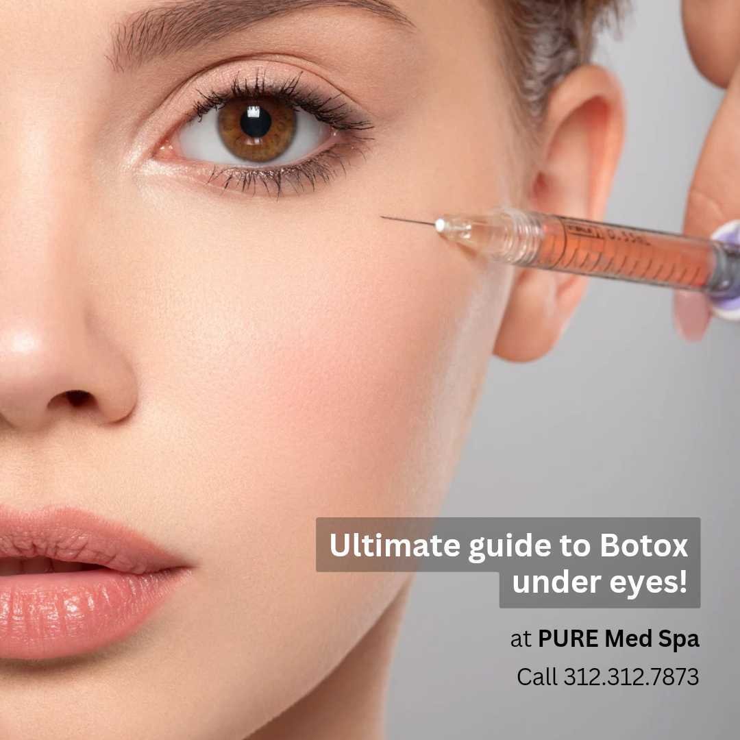 botox-under-eyes botox-under-eyes