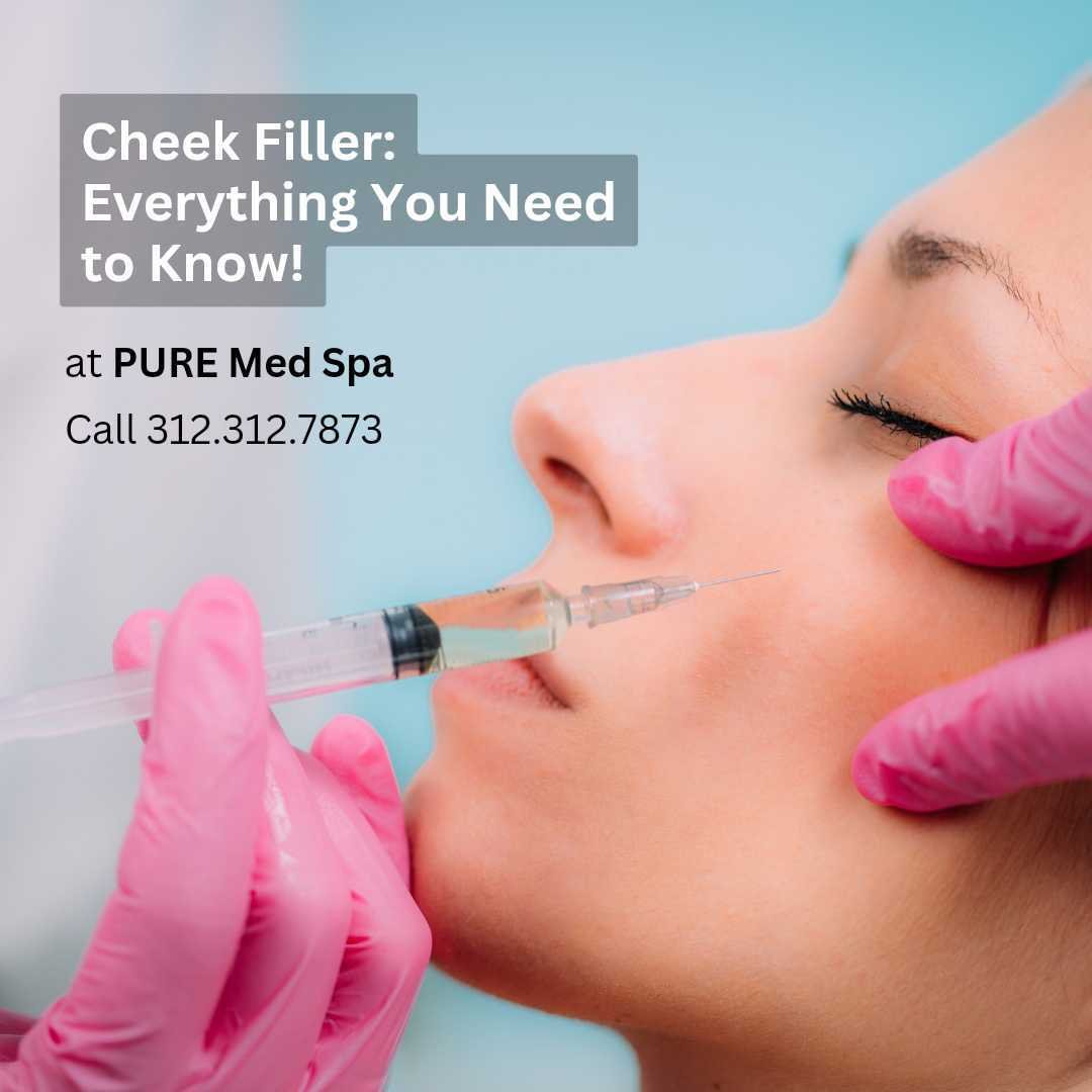 cheek-filler cheek-filler