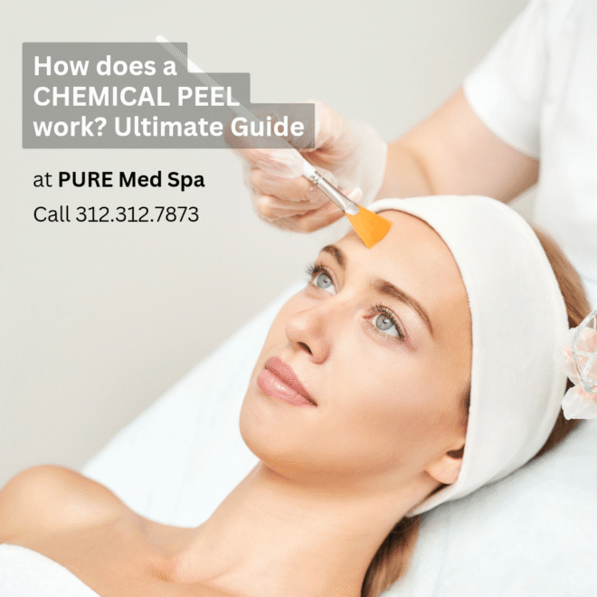 how-does-chemical-peel-work