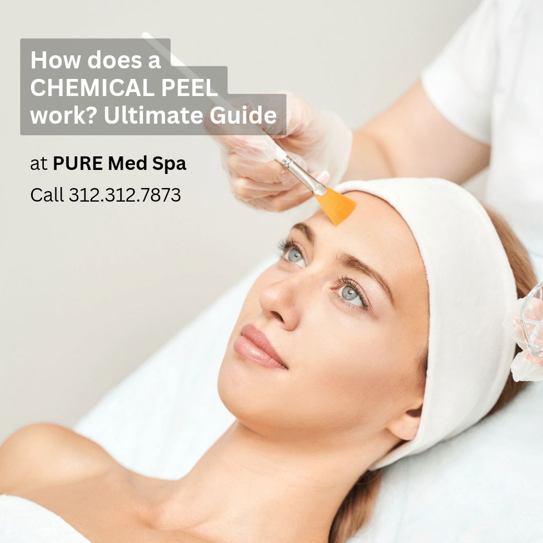 how-does-chemical-peel-work how-does-chemical-peel-work