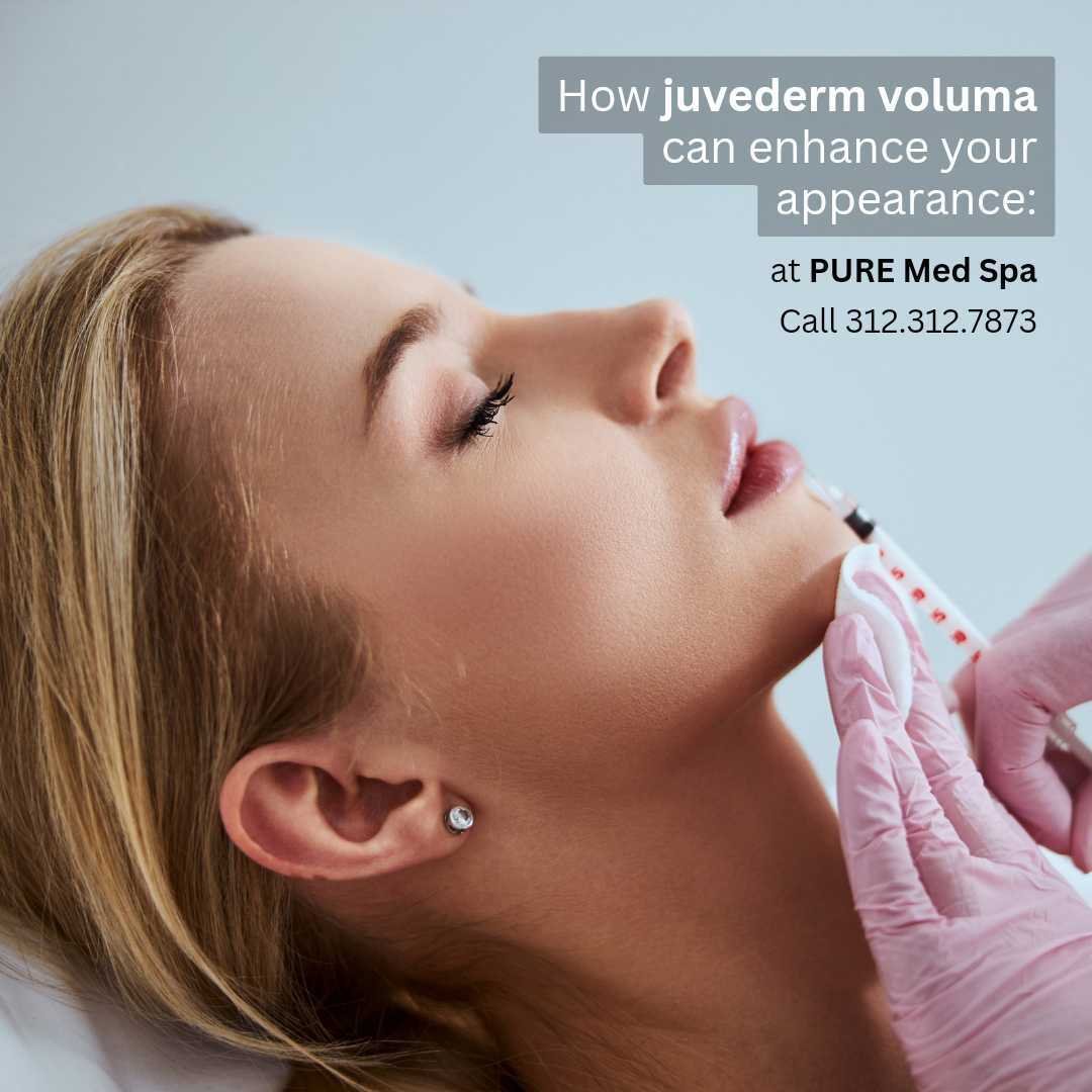 Juvederm Voluma Chicago, Enhance Your Appearance Juvederm Voluma Chicago, Enhance Your Appearance