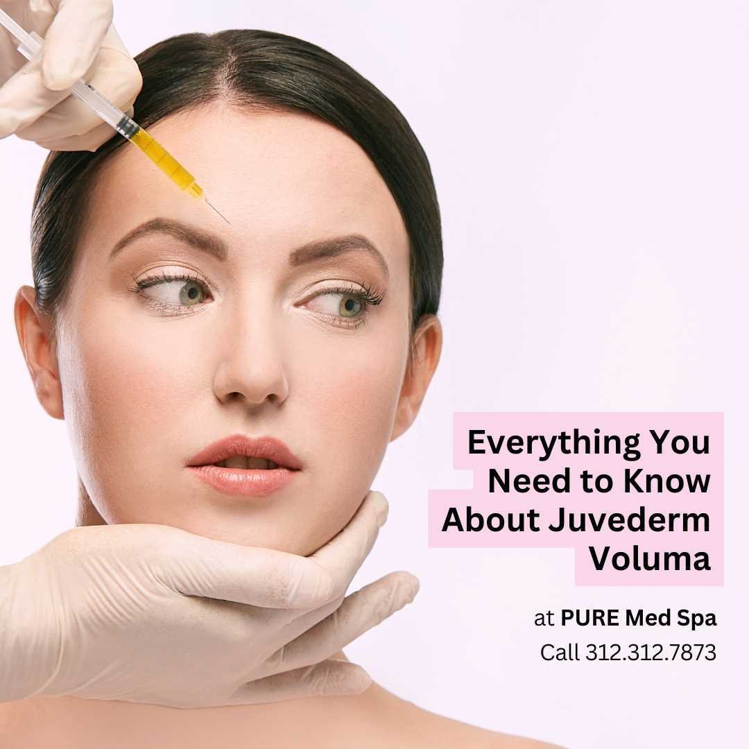 Juvederm Voluma Everything you Need to Know Juvederm Voluma Everything you Need to Know
