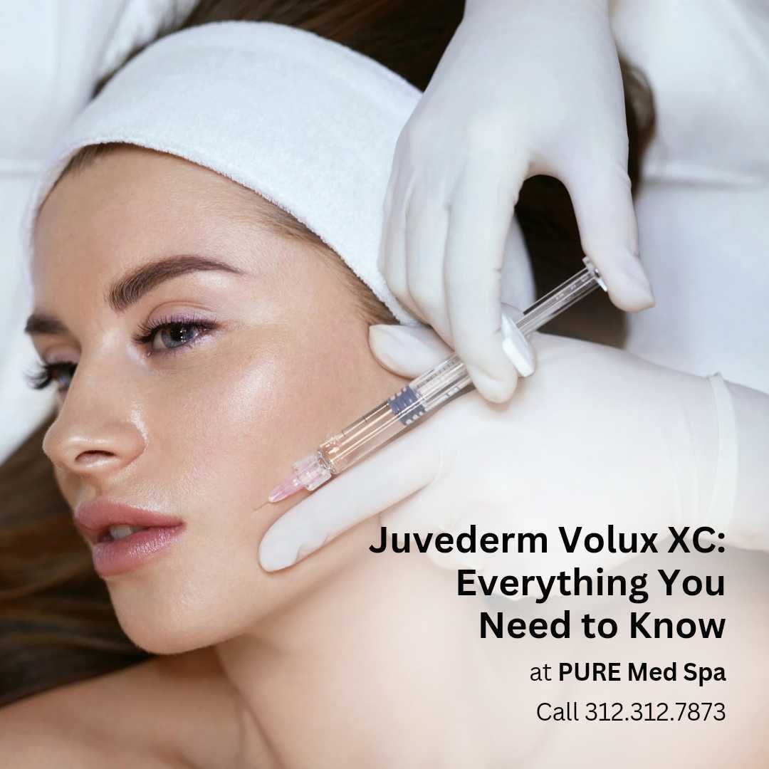 juvederm-volux-xc juvederm-volux-xc