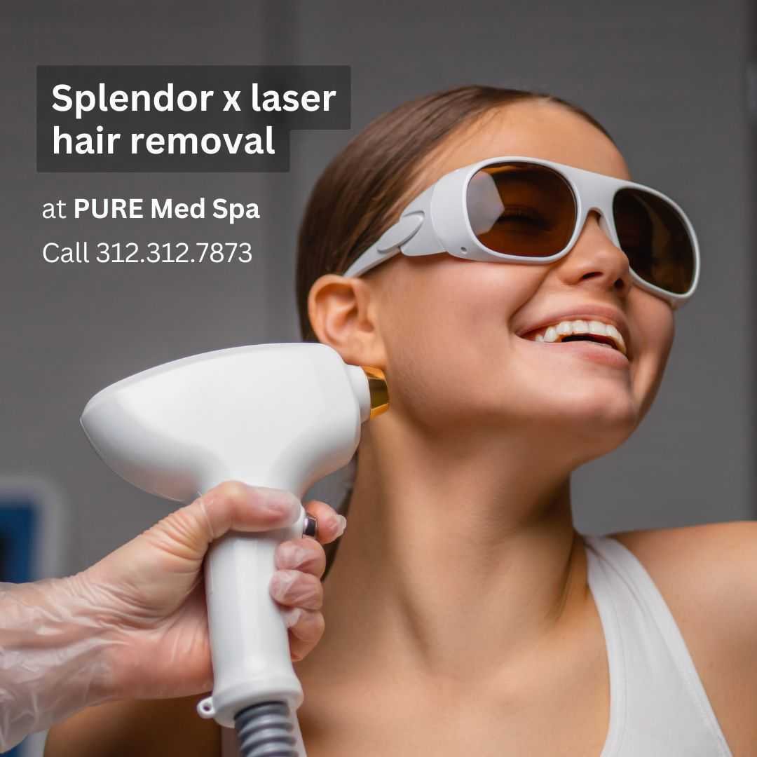 splendor-x-laser splendor-x-laser