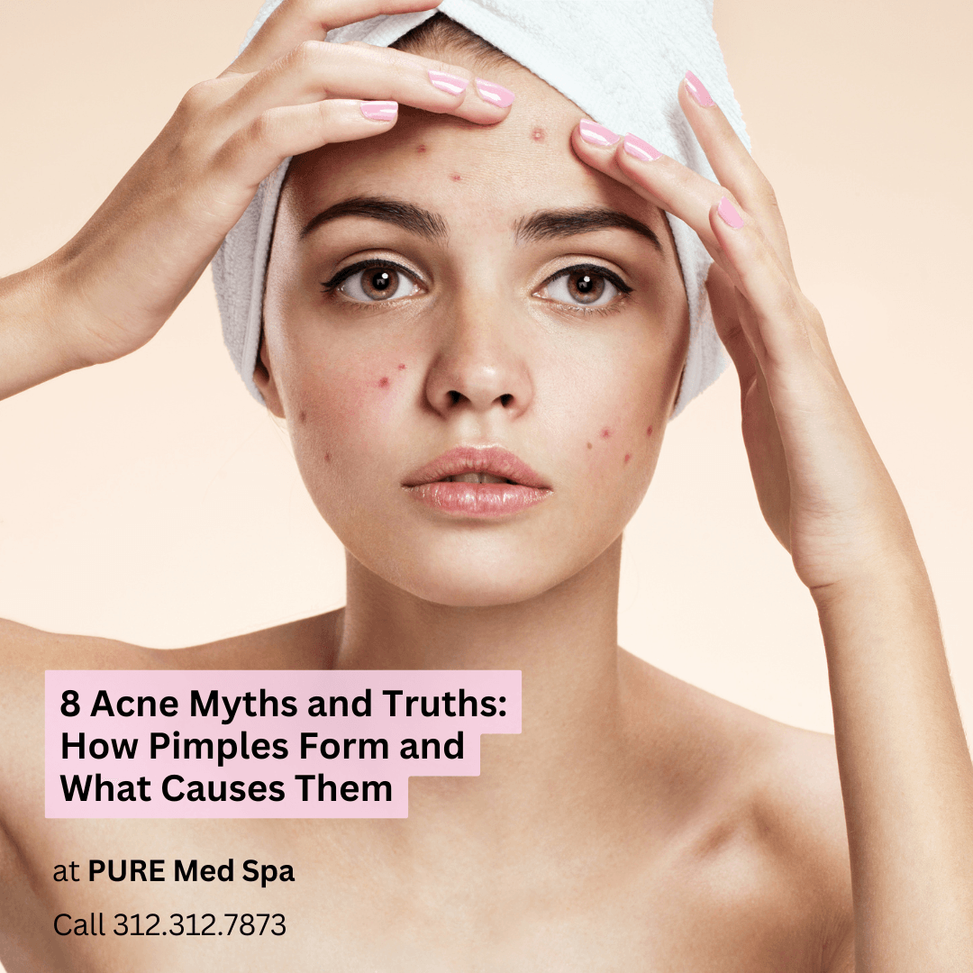 8 Acne Myths and Truths 8 Acne Myths and Truths