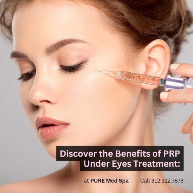 Discover the Benefits of PRP Under Eyes Treatment Discover the Benefits of PRP Under Eyes Treatment