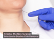 Double Chin Removal