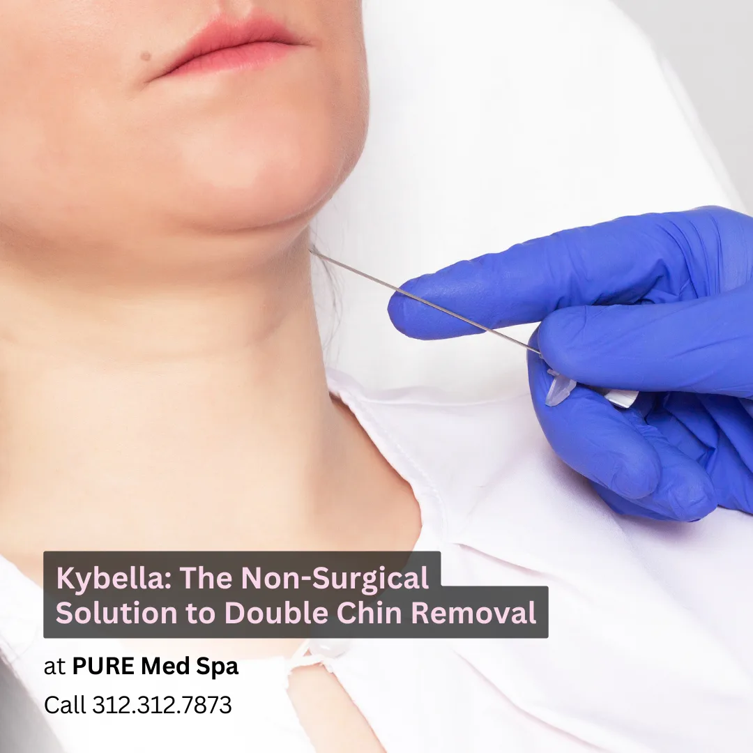 Double Chin Removal Double Chin Removal