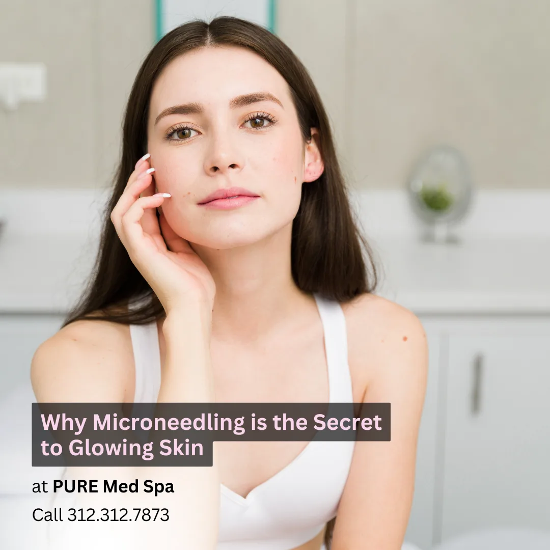 Microneedling Microneedling