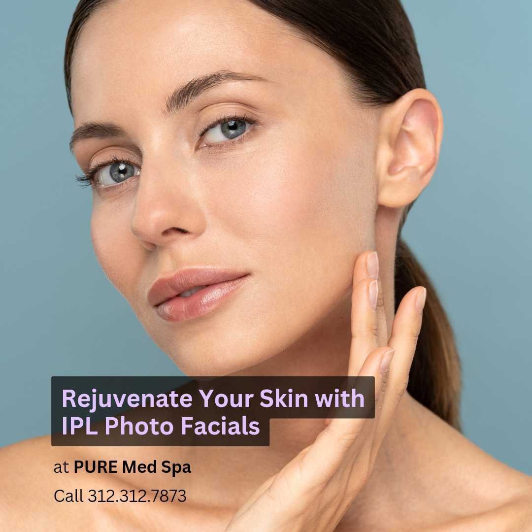 ipl-photo-facials ipl photo facials
