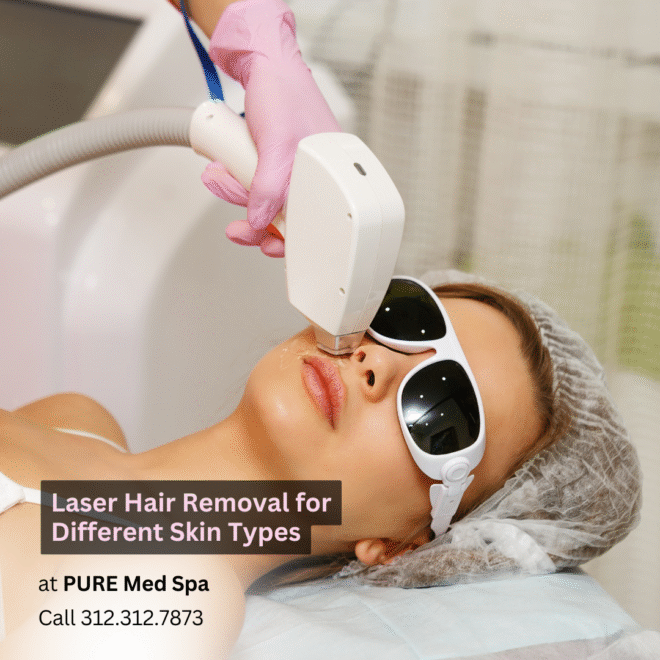 laser-hair-removal-for-different-skin-types laser hair removal for different skin types