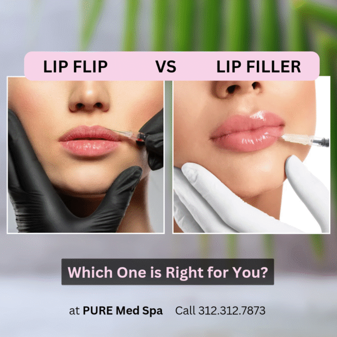 lip-flip-vs-lip-filler lip flip vs lip filler
