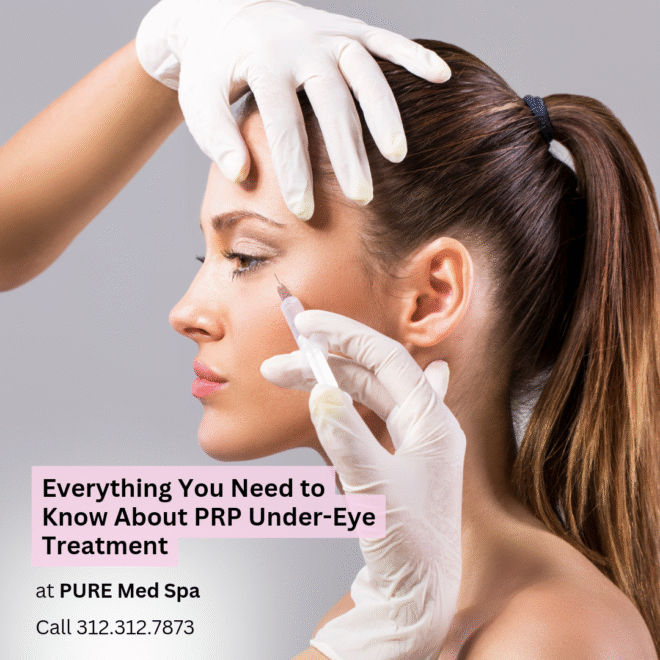 prp-under-eye prp under eye