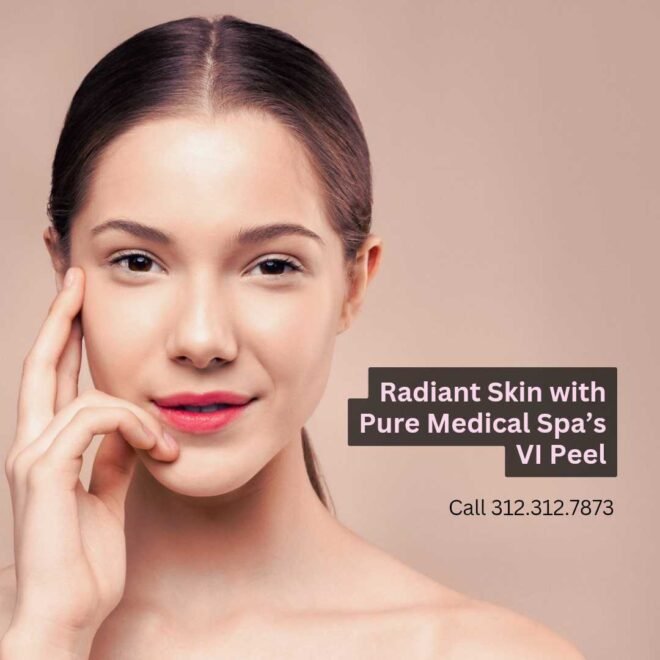 radiant vi peel