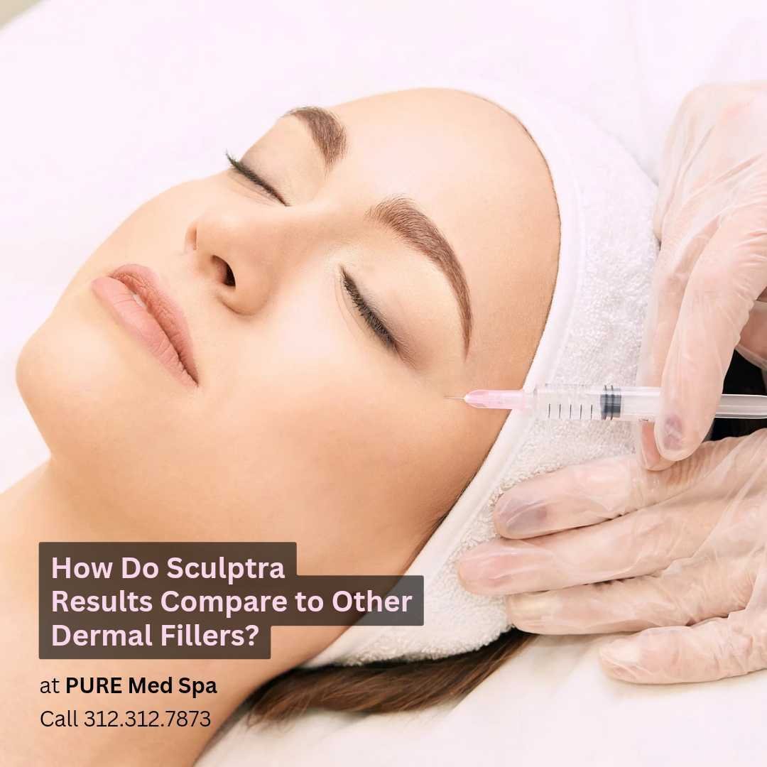 scultpra-vs-other-dermal-fillers scultpra vs other dermal fillers
