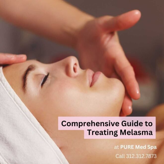 treating-melasma treating melasma