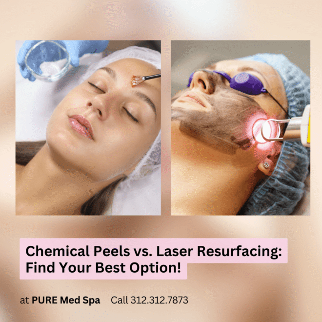 Chemical Peels vs. Laser Resurfacing