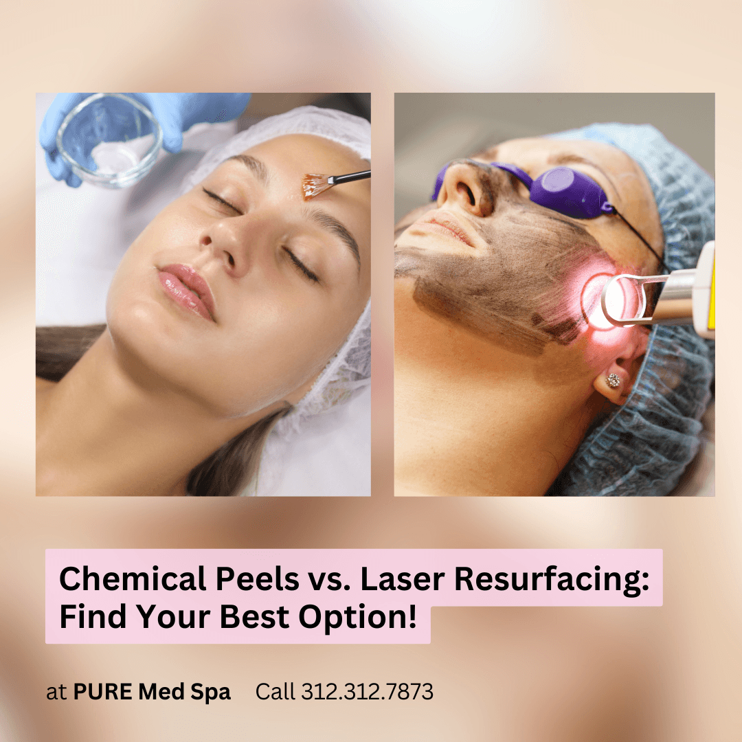 Chemical Peels vs. Laser Resurfacing Find Your Best Option!_20241003_123637_0000 Chemical Peels vs. Laser Resurfacing
