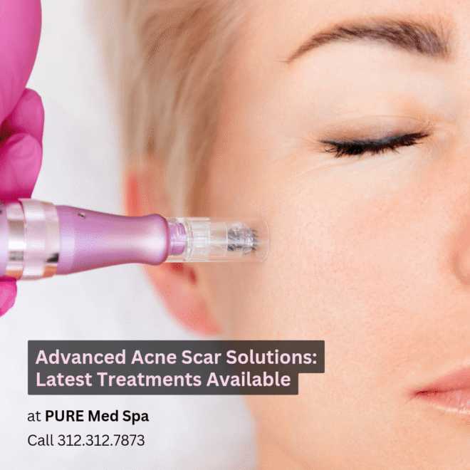 Advanced Acne Scar Solutions Advanced Acne Scar Solutions