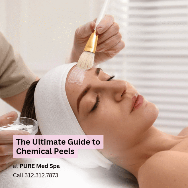 The Ultimate Guide to Chemical Peels