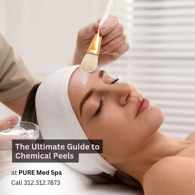 The Ultimate Guide to Chemical Peels at Chicago The Ultimate Guide to Chemical Peels at Chicago