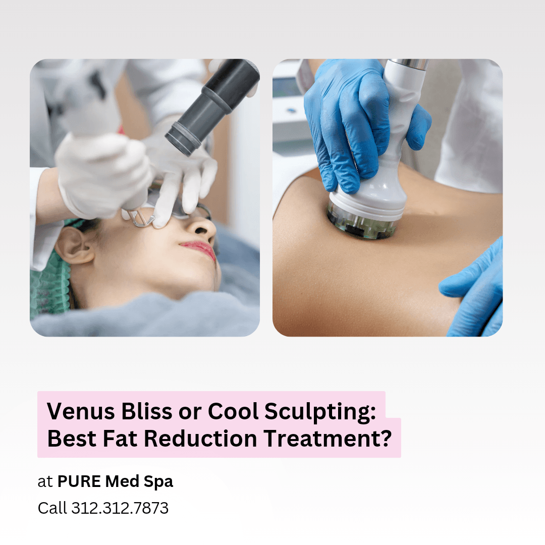 Venus Bliss or Cool Sculpting_ Best Fat Reduction Treatment