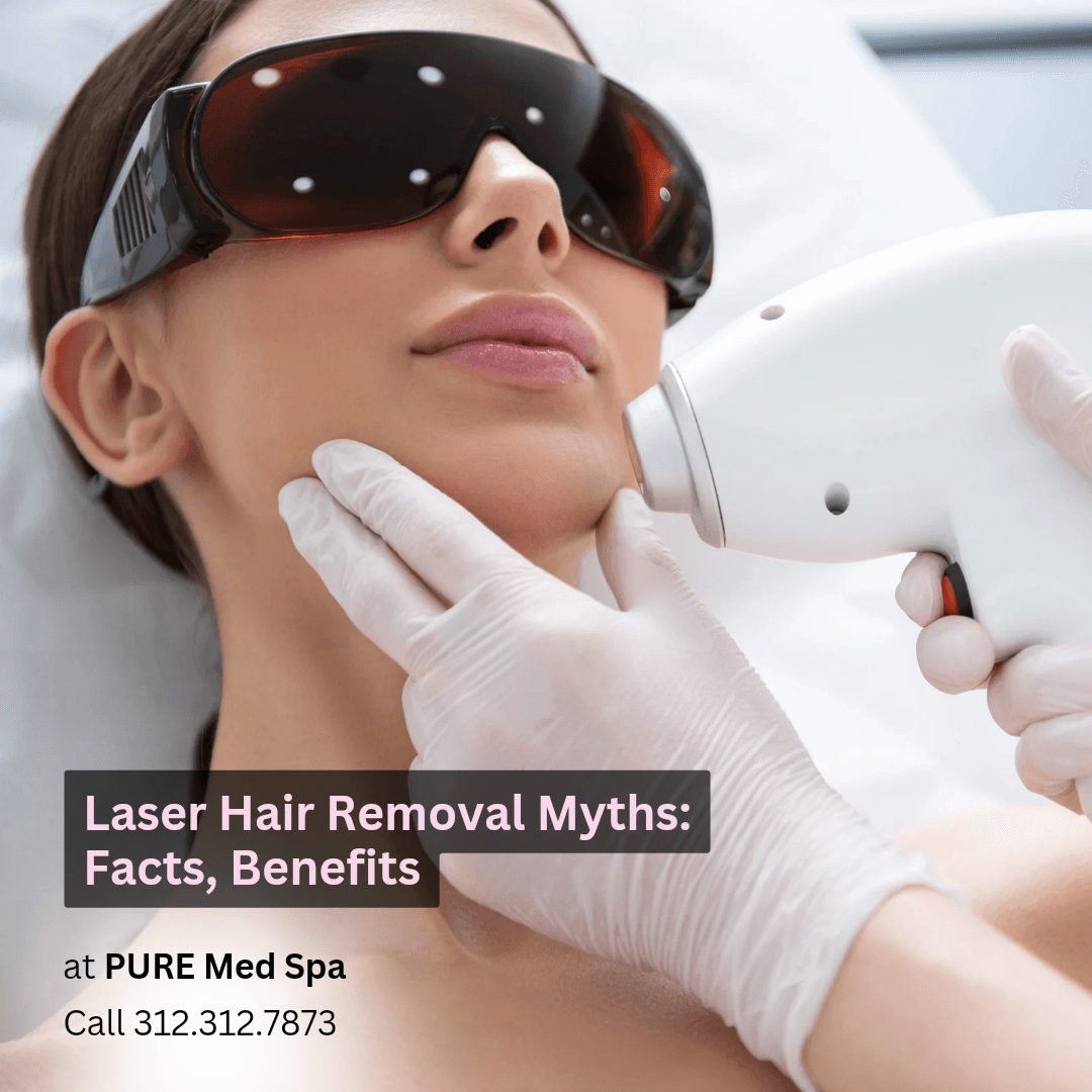Laser Hair Removal Myths Facts, Benefits Laser Hair Removal Myths Facts, Benefits