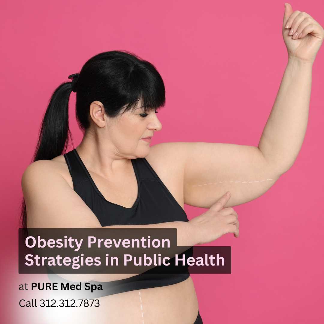 Obesity Prevention Strategies in Public Health Obesity Prevention Strategies in Public Health