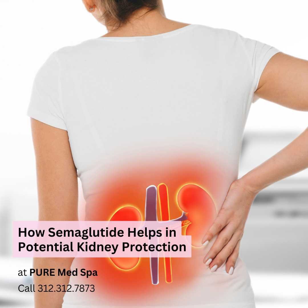 How Semaglutide Helps in Potential Kidney Protection How Semaglutide Helps in Potential Kidney Protection