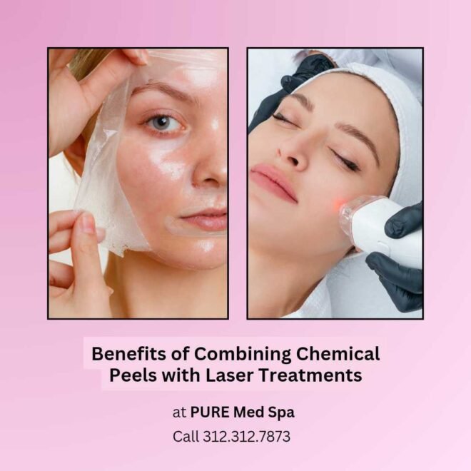 Benefits of Combining Chemical Peels with Laser Treatments